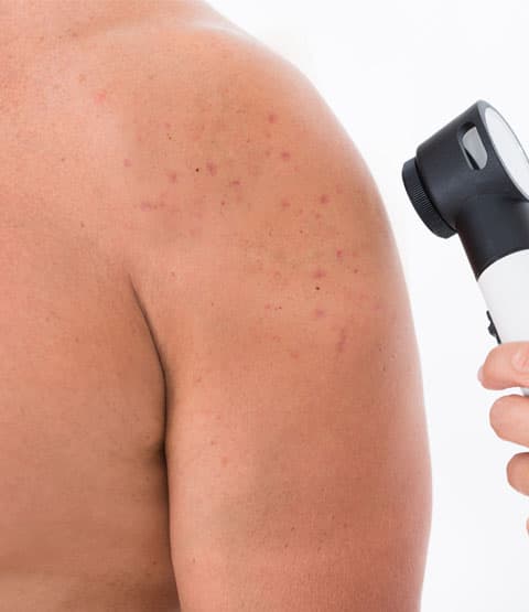 Özel Elos Lazer Polikliniği - Cilt Bakımı - 19. Fotoğraf Özel Elos Lazer Polikliniği - Cilt Bakımı - 19. Fotoğraf