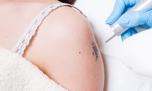 Özel Elos Lazer Polikliniği - Cilt Bakımı