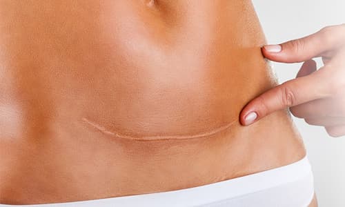 Özel Elos Lazer Polikliniği - Cilt Bakımı