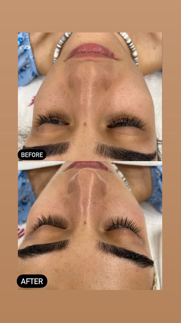 Sıla Zengin Güzellik Salonu - 177. Fotoğraf Sıla Zengin Güzellik Salonu - 177. Fotoğraf