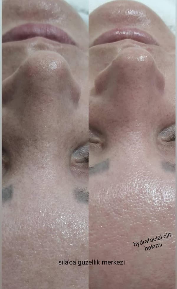 Sıla Zengin Güzellik Salonu - 26. Fotoğraf Sıla Zengin Güzellik Salonu - 26. Fotoğraf