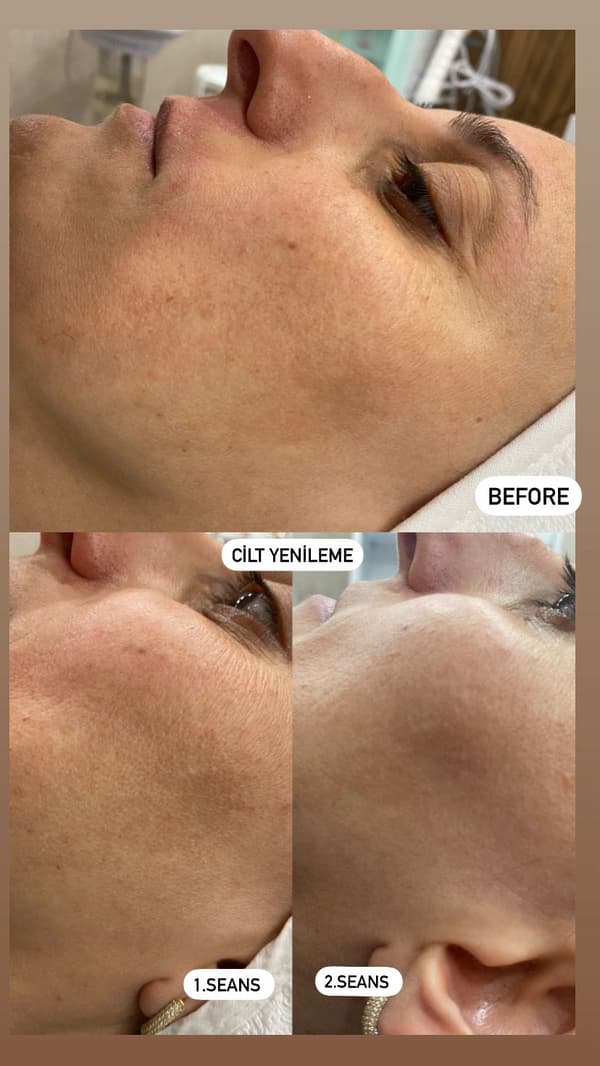 Sıla Zengin Güzellik Salonu - 182. Fotoğraf Sıla Zengin Güzellik Salonu - 182. Fotoğraf