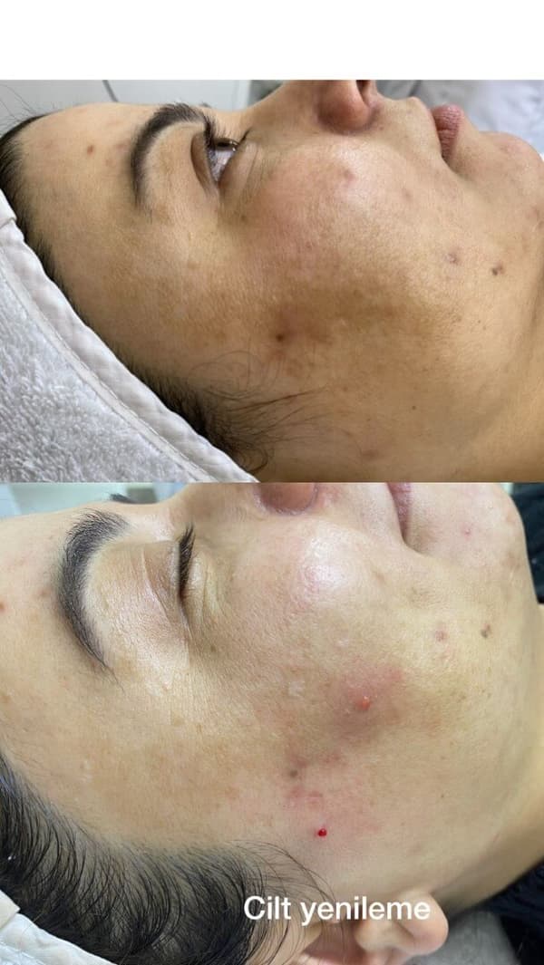 Sıla Zengin Güzellik Salonu - 82. Fotoğraf Sıla Zengin Güzellik Salonu - 82. Fotoğraf