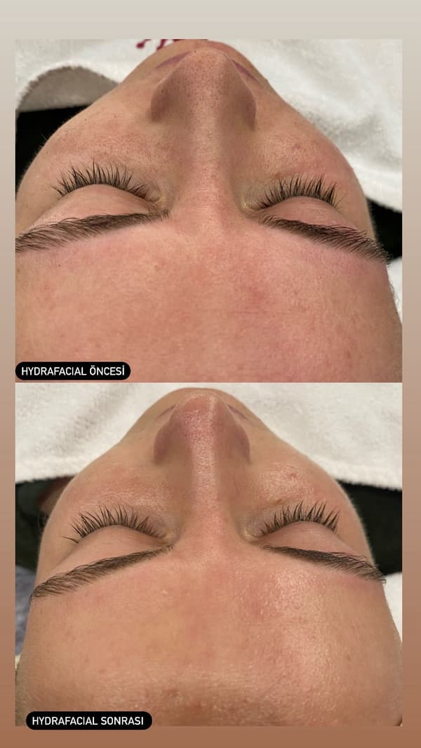 Sıla Zengin Güzellik Salonu - 183. Fotoğraf Sıla Zengin Güzellik Salonu - 183. Fotoğraf