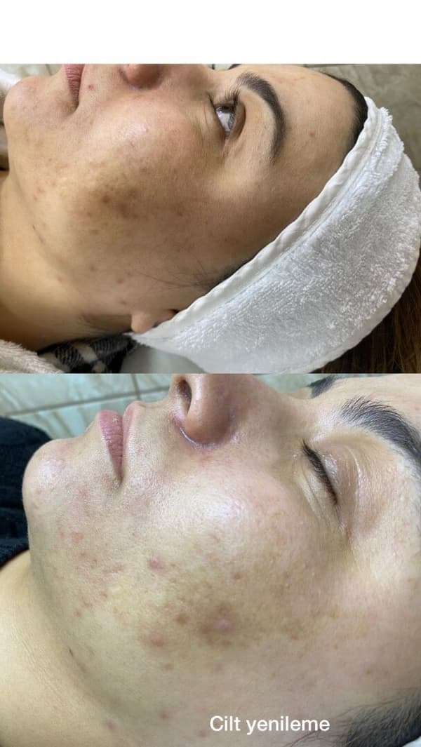 Sıla Zengin Güzellik Salonu - 83. Fotoğraf Sıla Zengin Güzellik Salonu - 83. Fotoğraf