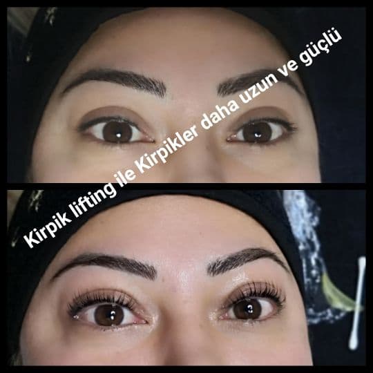 Yeliz Gazeloğlu Beauty Center