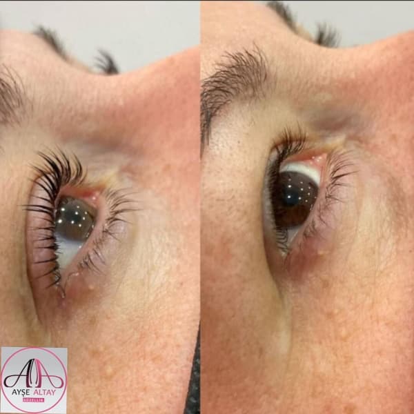 Ayşe Alya Güzellik Merkezi - 107. Fotoğraf Ayşe Alya Güzellik Merkezi - 107. Fotoğraf