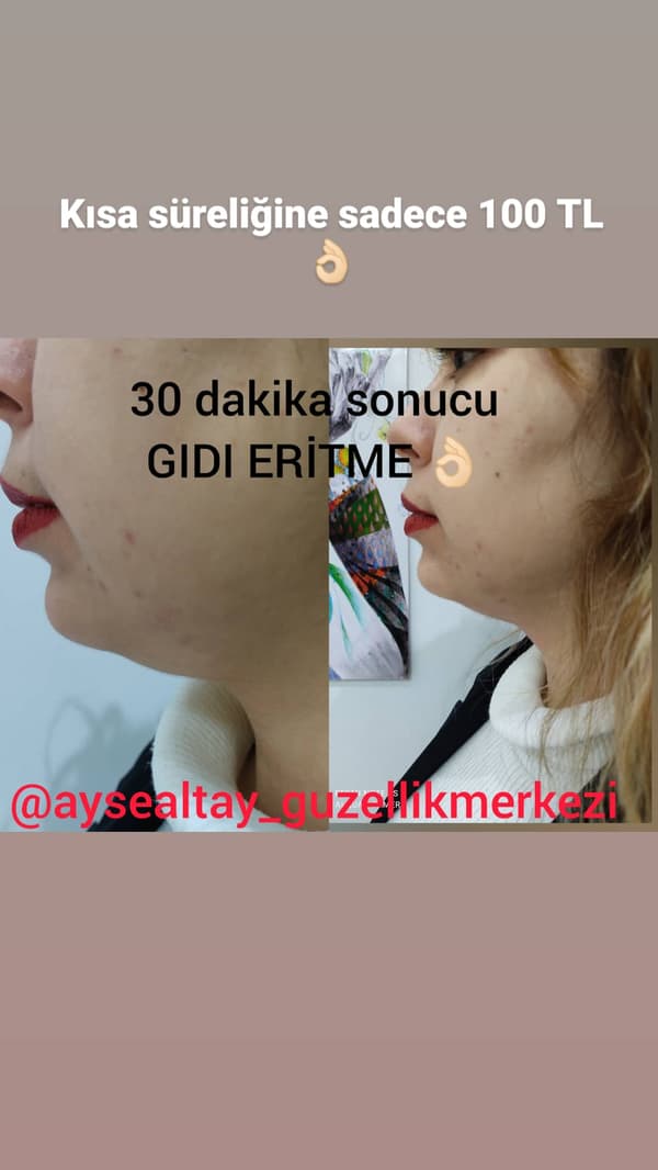 Ayşe Alya Güzellik Merkezi - 20. Fotoğraf Ayşe Alya Güzellik Merkezi - 20. Fotoğraf