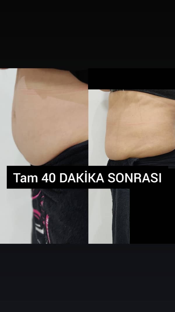 Ayşe Alya Güzellik Merkezi - 12. Fotoğraf Ayşe Alya Güzellik Merkezi - 12. Fotoğraf