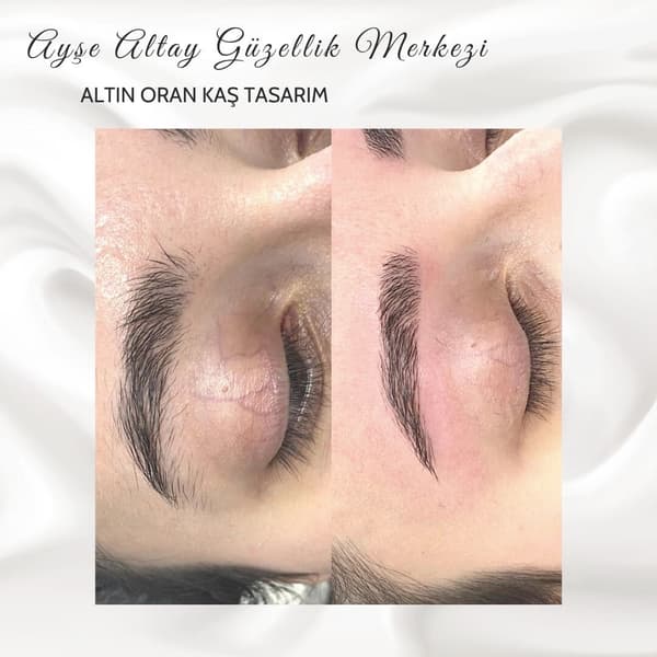 Ayşe Altay Güzellik Merkezi - 151. Fotoğraf