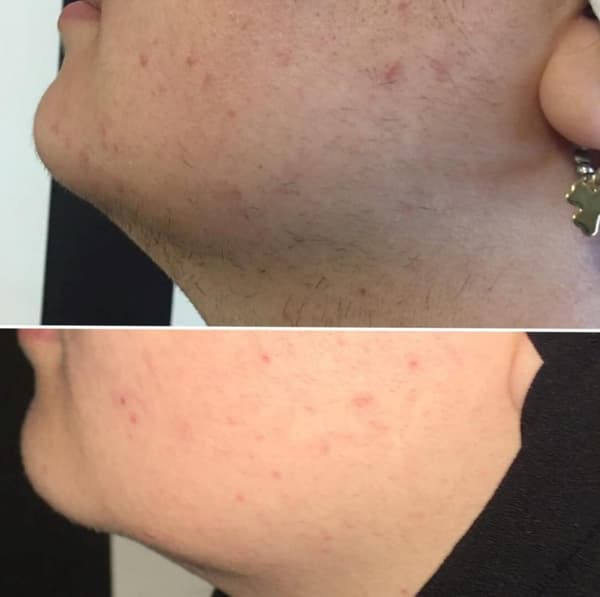 Ayşe Alya Güzellik Merkezi - 101. Fotoğraf Ayşe Alya Güzellik Merkezi - 101. Fotoğraf