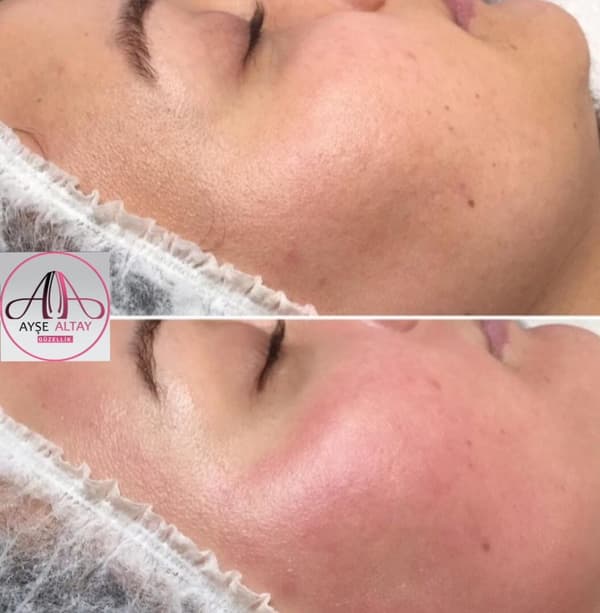 Ayşe Alya Güzellik Merkezi - 84. Fotoğraf Ayşe Alya Güzellik Merkezi - 84. Fotoğraf
