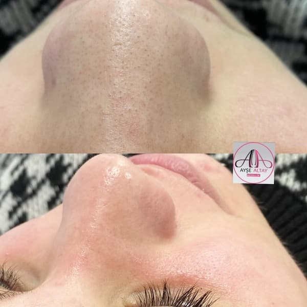 Ayşe Alya Güzellik Merkezi - 136. Fotoğraf Ayşe Alya Güzellik Merkezi - 136. Fotoğraf