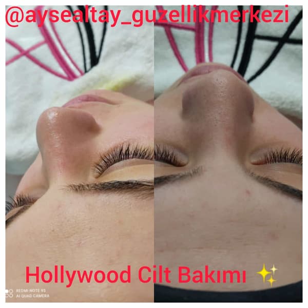 Ayşe Alya Güzellik Merkezi - 10. Fotoğraf Ayşe Alya Güzellik Merkezi - 10. Fotoğraf