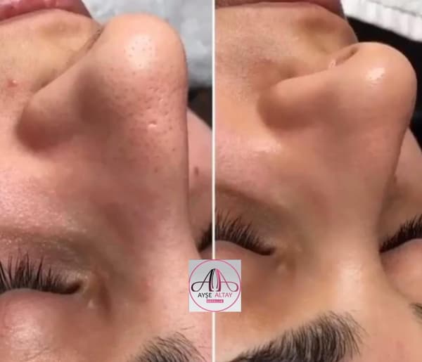 Ayşe Alya Güzellik Merkezi - 96. Fotoğraf Ayşe Alya Güzellik Merkezi - 96. Fotoğraf