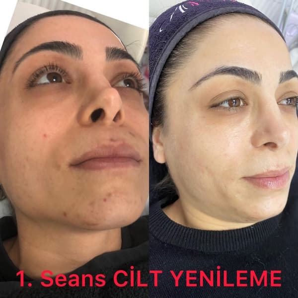Ayşe Altay Güzellik Merkezi - 85. Fotoğraf