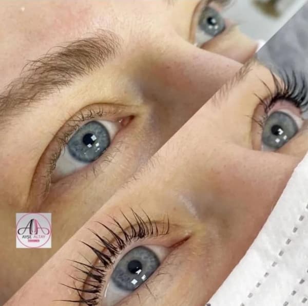 Ayşe Alya Güzellik Merkezi - 82. Fotoğraf Ayşe Alya Güzellik Merkezi - 82. Fotoğraf