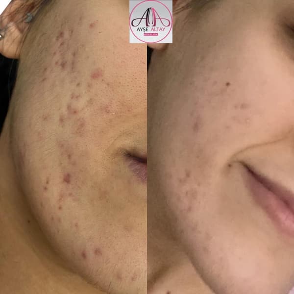 Ayşe Alya Güzellik Merkezi - 139. Fotoğraf Ayşe Alya Güzellik Merkezi - 139. Fotoğraf