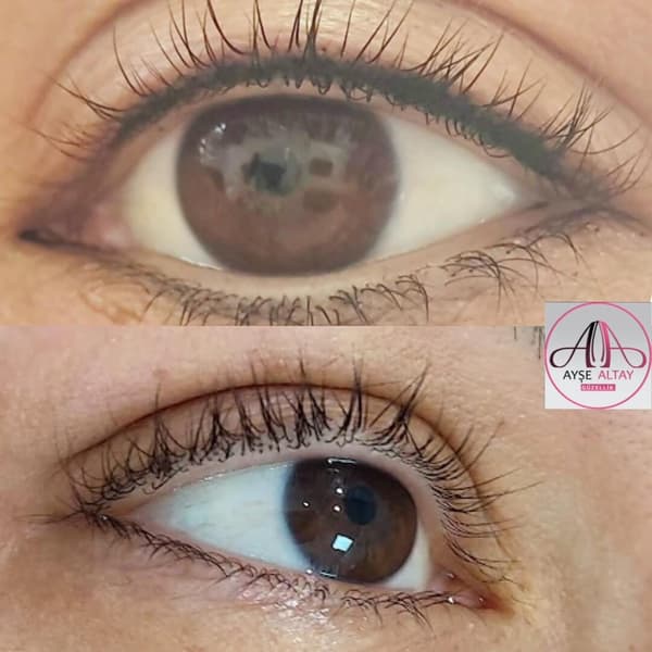 Ayşe Alya Güzellik Merkezi - 112. Fotoğraf Ayşe Alya Güzellik Merkezi - 112. Fotoğraf