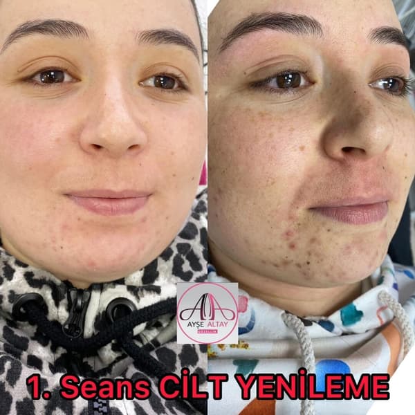 Ayşe Alya Güzellik Merkezi - 92. Fotoğraf Ayşe Alya Güzellik Merkezi - 92. Fotoğraf