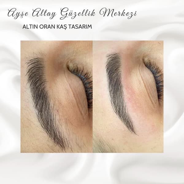 Ayşe Altay Güzellik Merkezi - 159. Fotoğraf