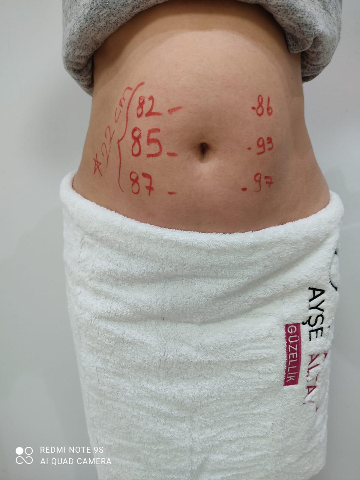 Ayşe Alya Güzellik Merkezi