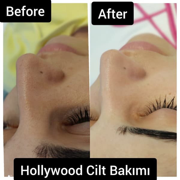 Ayşe Alya Güzellik Merkezi - 65. Fotoğraf Ayşe Alya Güzellik Merkezi - 65. Fotoğraf