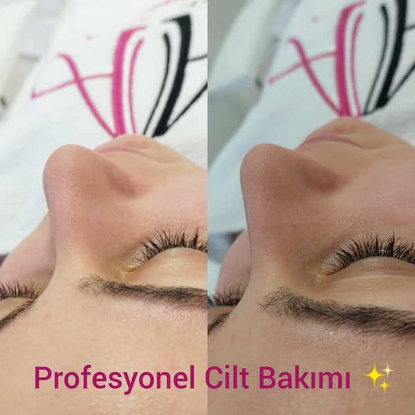 Ayşe Alya Güzellik Merkezi - 66. Fotoğraf Ayşe Alya Güzellik Merkezi - 66. Fotoğraf