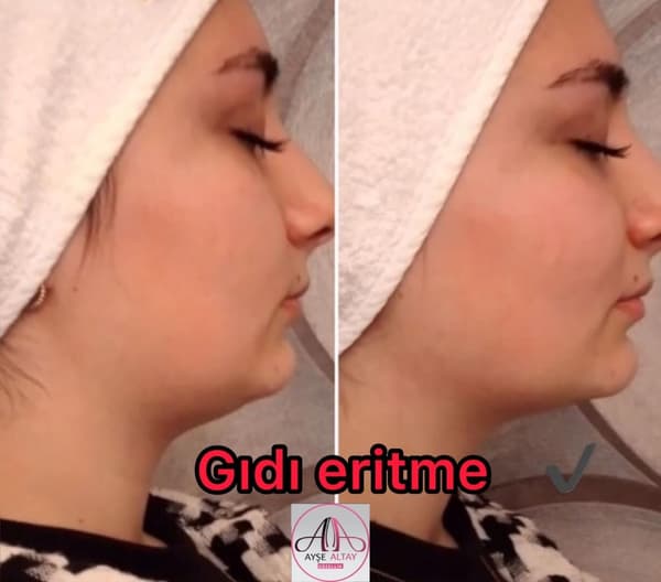 Ayşe Altay Güzellik Merkezi - 90. Fotoğraf