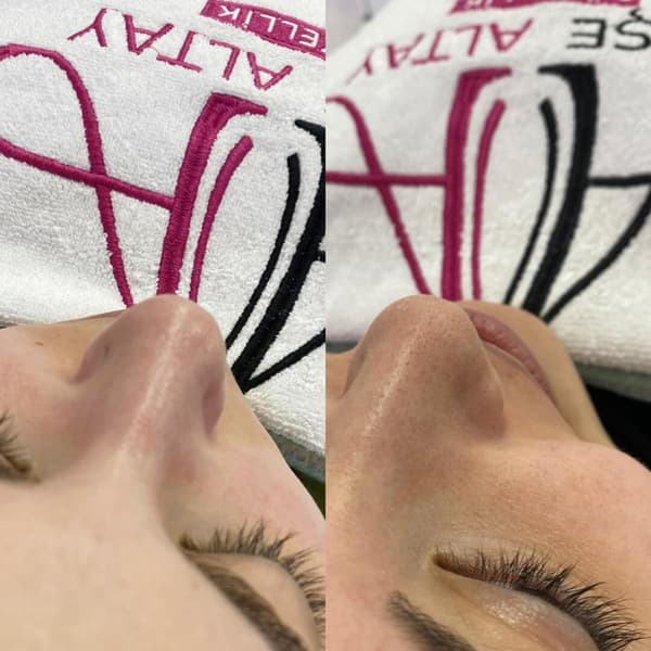 Ayşe Alya Güzellik Merkezi - 80. Fotoğraf Ayşe Alya Güzellik Merkezi - 80. Fotoğraf