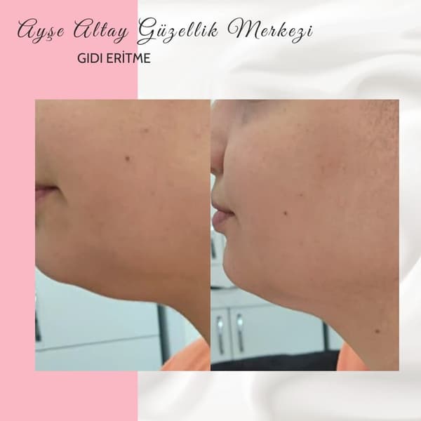 Ayşe Altay Güzellik Merkezi - 143. Fotoğraf