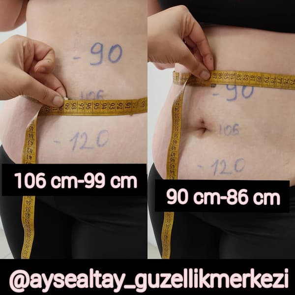 Ayşe Alya Güzellik Merkezi - 16. Fotoğraf Ayşe Alya Güzellik Merkezi - 16. Fotoğraf