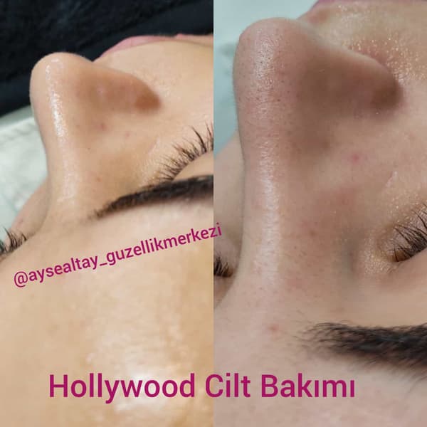 Ayşe Alya Güzellik Merkezi - 67. Fotoğraf Ayşe Alya Güzellik Merkezi - 67. Fotoğraf