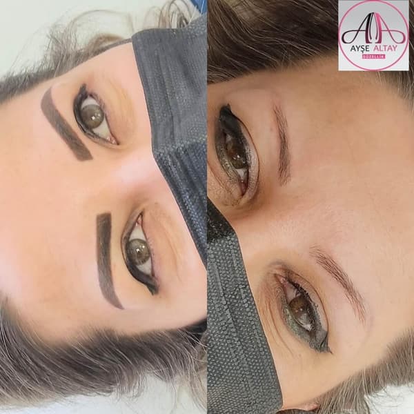 Ayşe Alya Güzellik Merkezi - 122. Fotoğraf Ayşe Alya Güzellik Merkezi - 122. Fotoğraf