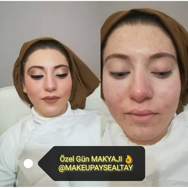 Ayşe Altay Güzellik Merkezi - 50. Fotoğraf
