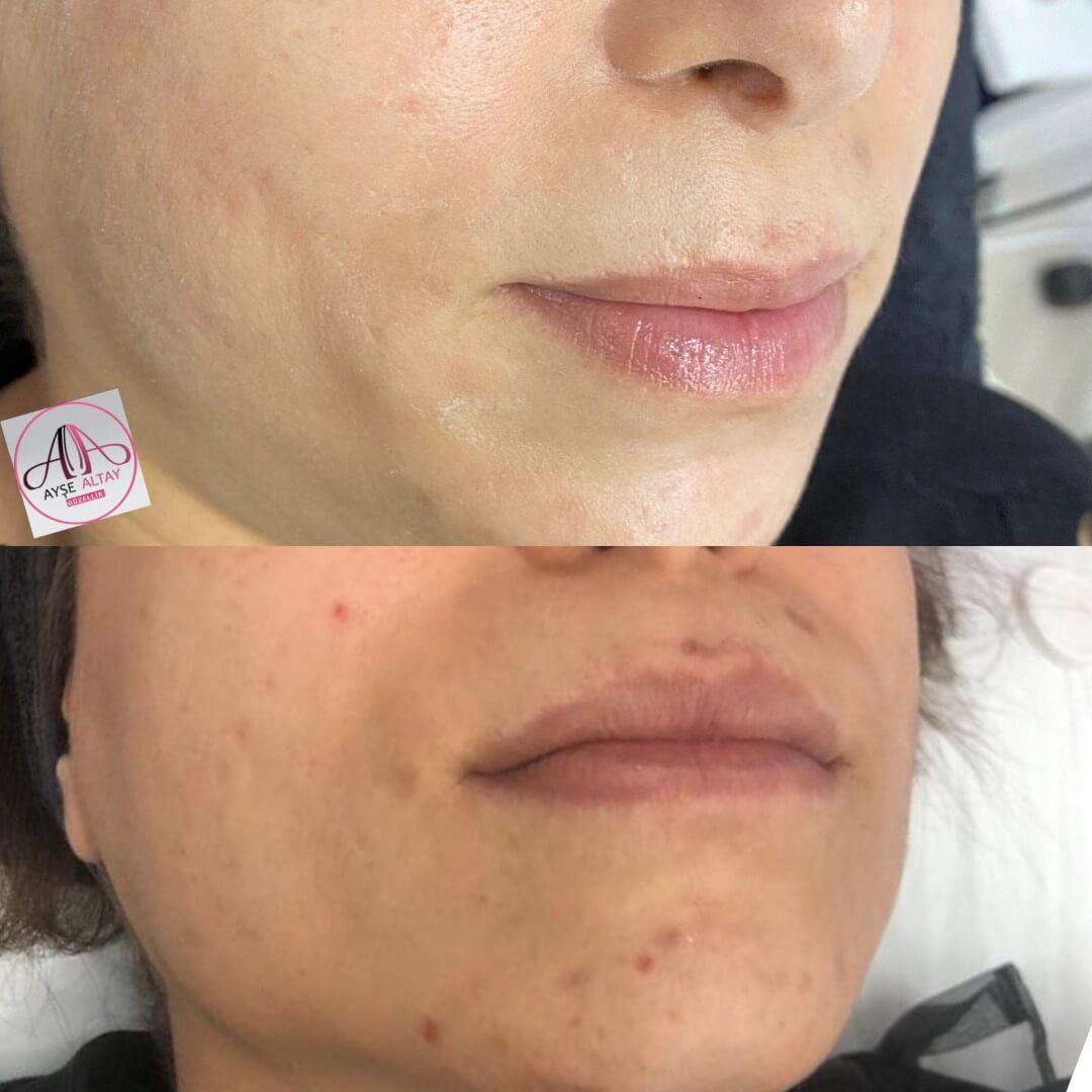 Ayşe Alya Güzellik Merkezi