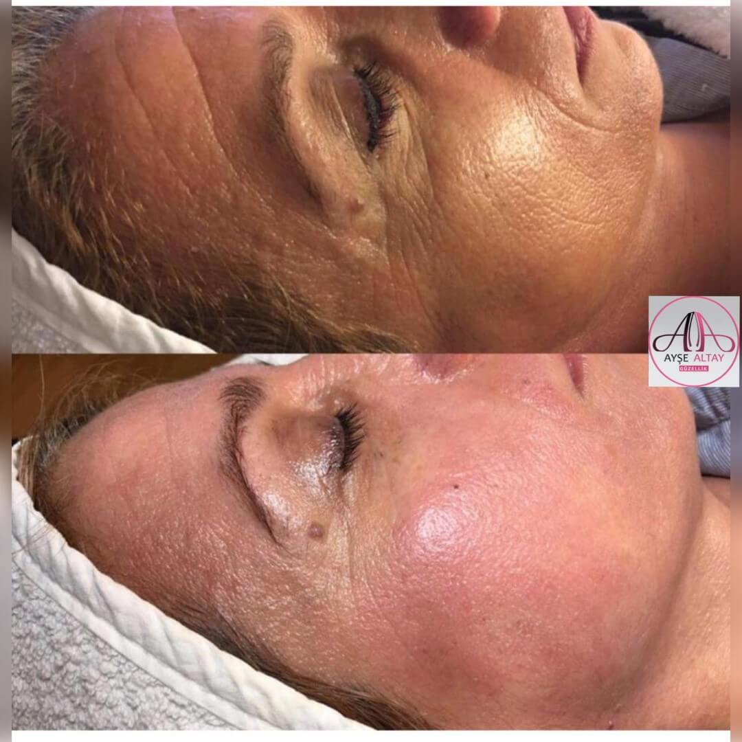 Ayşe Alya Güzellik Merkezi