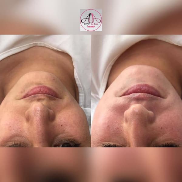 Ayşe Alya Güzellik Merkezi - 137. Fotoğraf Ayşe Alya Güzellik Merkezi - 137. Fotoğraf