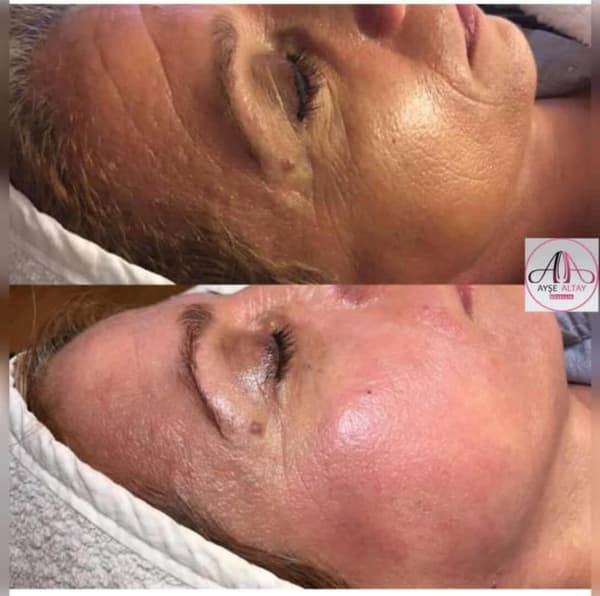 Ayşe Alya Güzellik Merkezi - 81. Fotoğraf Ayşe Alya Güzellik Merkezi - 81. Fotoğraf