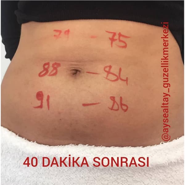 Ayşe Alya Güzellik Merkezi - 25. Fotoğraf Ayşe Alya Güzellik Merkezi - 25. Fotoğraf