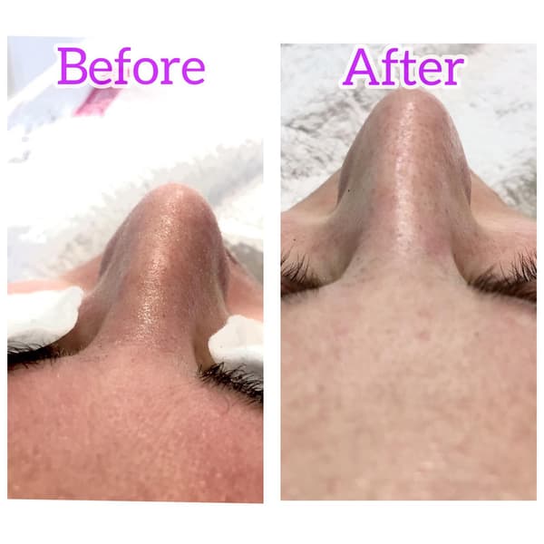 Ayşe Alya Güzellik Merkezi - 69. Fotoğraf Ayşe Alya Güzellik Merkezi - 69. Fotoğraf