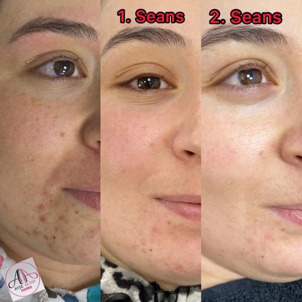 Ayşe Alya Güzellik Merkezi - 140. Fotoğraf Ayşe Alya Güzellik Merkezi - 140. Fotoğraf