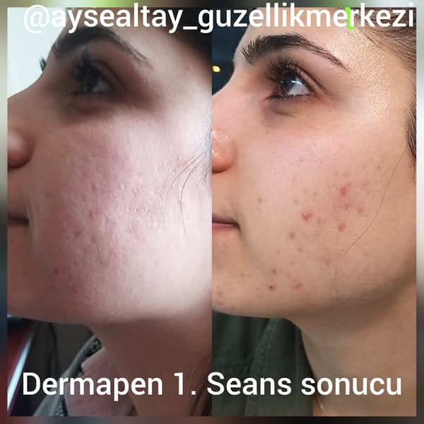 Ayşe Alya Güzellik Merkezi - 8. Fotoğraf Ayşe Alya Güzellik Merkezi - 8. Fotoğraf