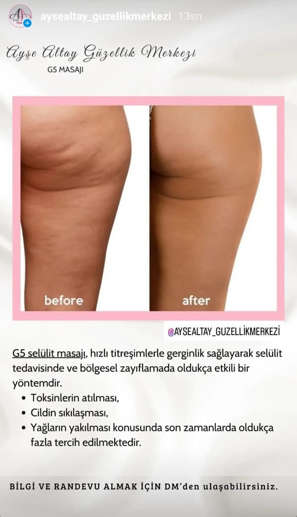 Ayşe Altay Güzellik Merkezi - 160. Fotoğraf