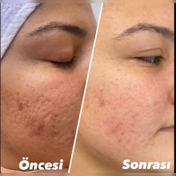 Ayşe Alya Güzellik Merkezi - 119. Fotoğraf Ayşe Alya Güzellik Merkezi - 119. Fotoğraf