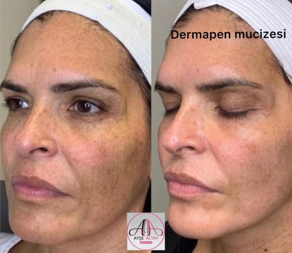 Ayşe Alya Güzellik Merkezi - 120. Fotoğraf Ayşe Alya Güzellik Merkezi - 120. Fotoğraf