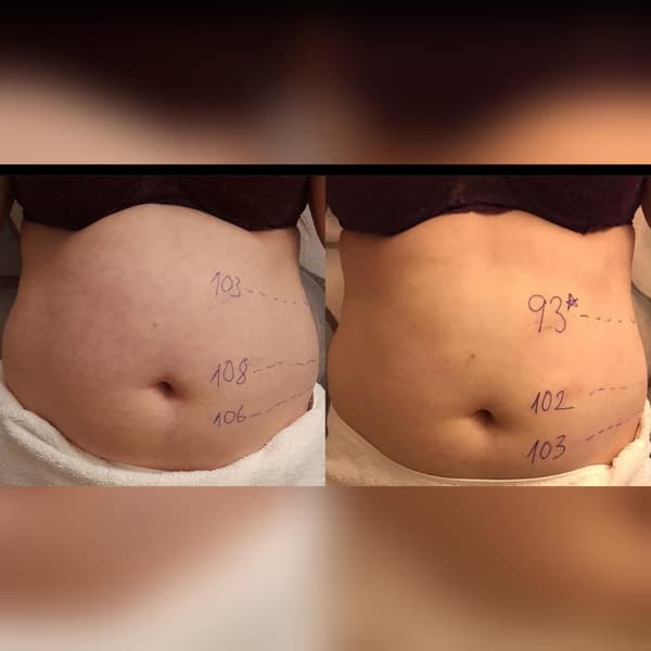 Ayşe Alya Güzellik Merkezi - 17. Fotoğraf Ayşe Alya Güzellik Merkezi - 17. Fotoğraf