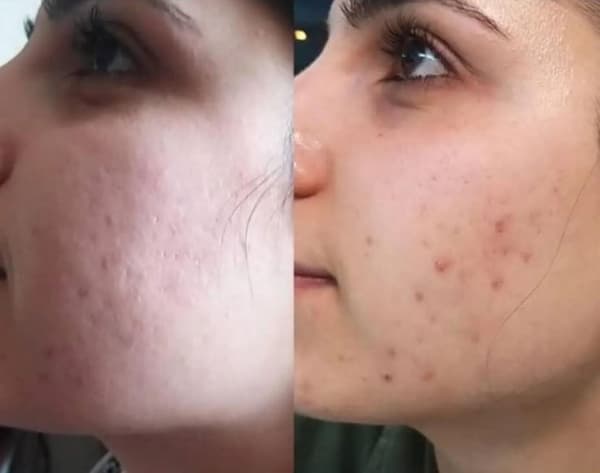 Ayşe Alya Güzellik Merkezi - 115. Fotoğraf Ayşe Alya Güzellik Merkezi - 115. Fotoğraf