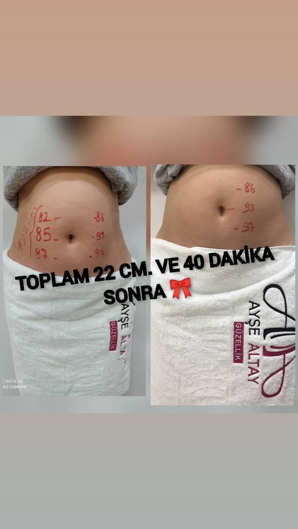 Ayşe Alya Güzellik Merkezi - 13. Fotoğraf Ayşe Alya Güzellik Merkezi - 13. Fotoğraf