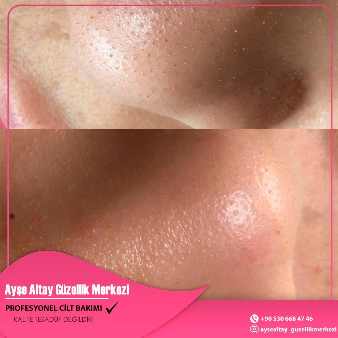 Ayşe Alya Güzellik Merkezi